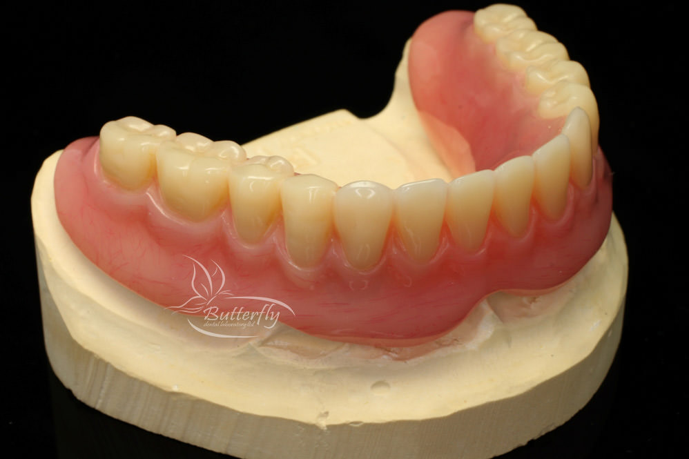 BDLab Dental Laboratory Dental Implants, Prosthesis Acrylic Dentures