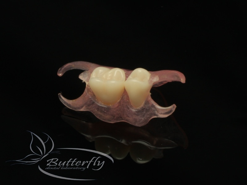 BDLab Dental Laboratory Dental Implants, Prosthesis Flexi Denture