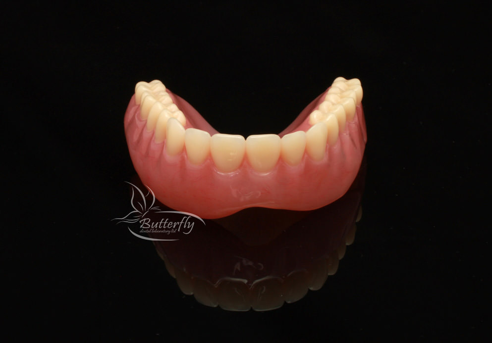 BDLab Dental Laboratory Dental Implants, Prosthesis Acrylic Dentures